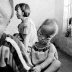 agent-orange-deformities-vietnam2