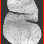 Concrete Enema Concrete Enema