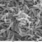 Cholera Bacteria