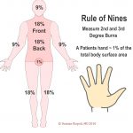 rule-of-nines rule-of-nines